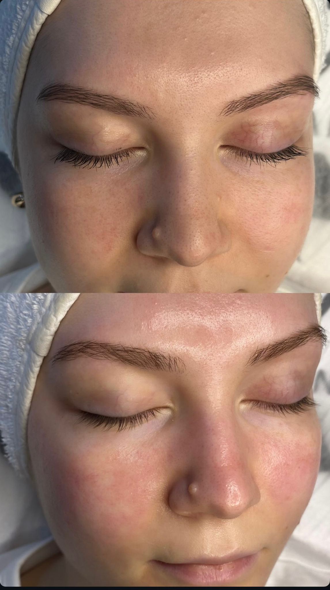 Mozaik galeri örneği 3: Bölgesel zayıflama